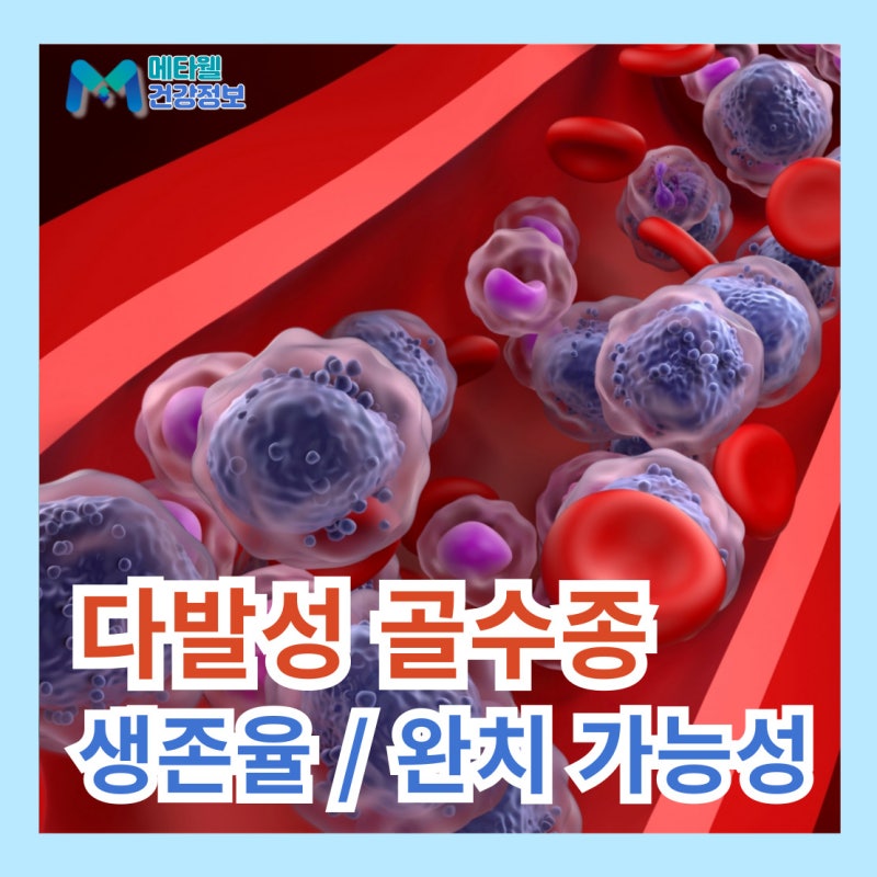 다발성 골수종 생존율 치료 완치 가능성은?