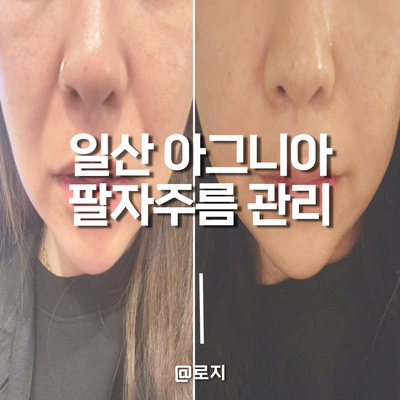  일산피부관리샵 아그니아 에스테틱. 미라젯 에끌라두 더마샷으로 리프팅 효과