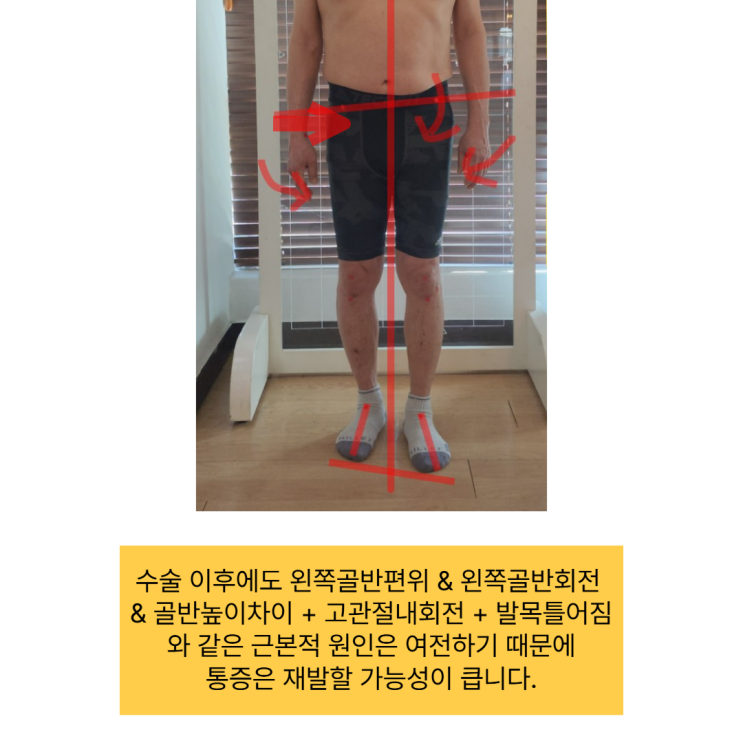  수술 후 무릎통증과 허리통증, 치료를 받아도 아픈건 그대로라면? (부산 동래 재활센터)
