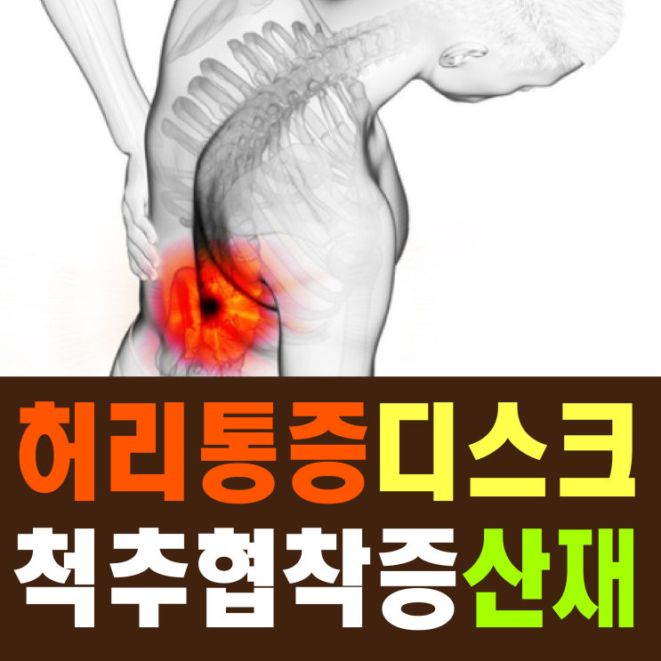  [허리통증 원인] 척추 디스크 협착증 산재 보상 신청하세요!
