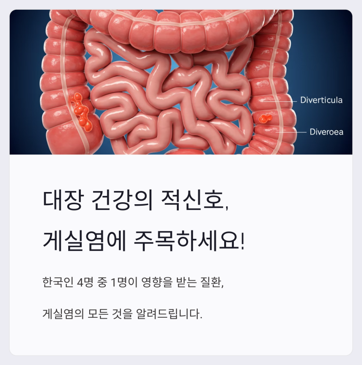  게실염 증상부터 예방법까지: 대장 건강 가이드