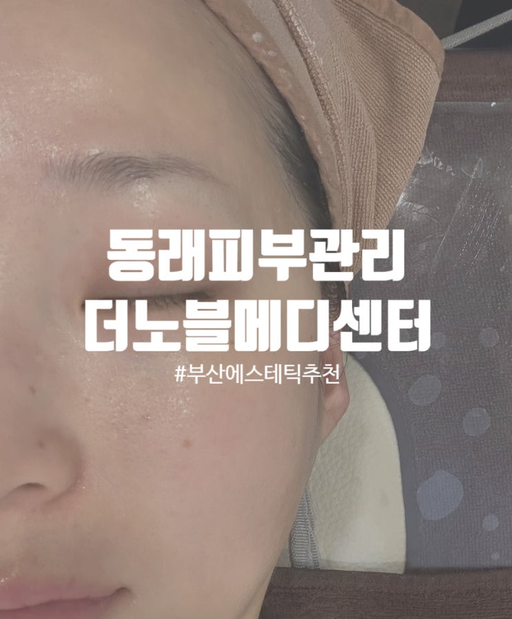  부산 온천동 피부관리 더노블메디센터 촉촉한 수분케어 후기
