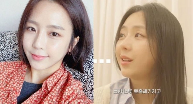 7개월 만에 컴백 예원, ‘코’ 달라졌네? “30대 귀염상 탈출하려 살짝” 쿨한 성형 고백