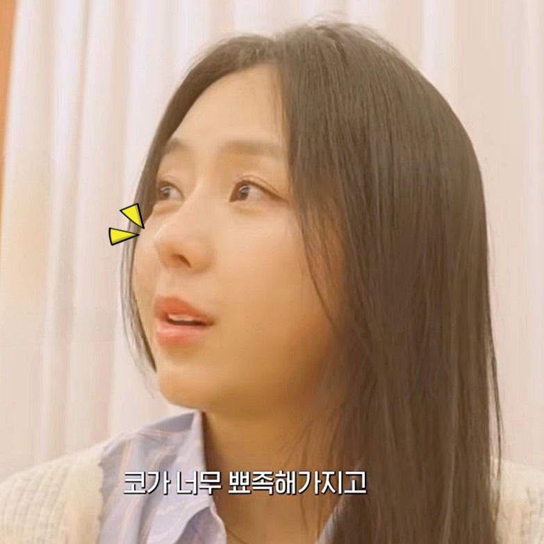 코 성형으로 달라진 예원 근황 모습