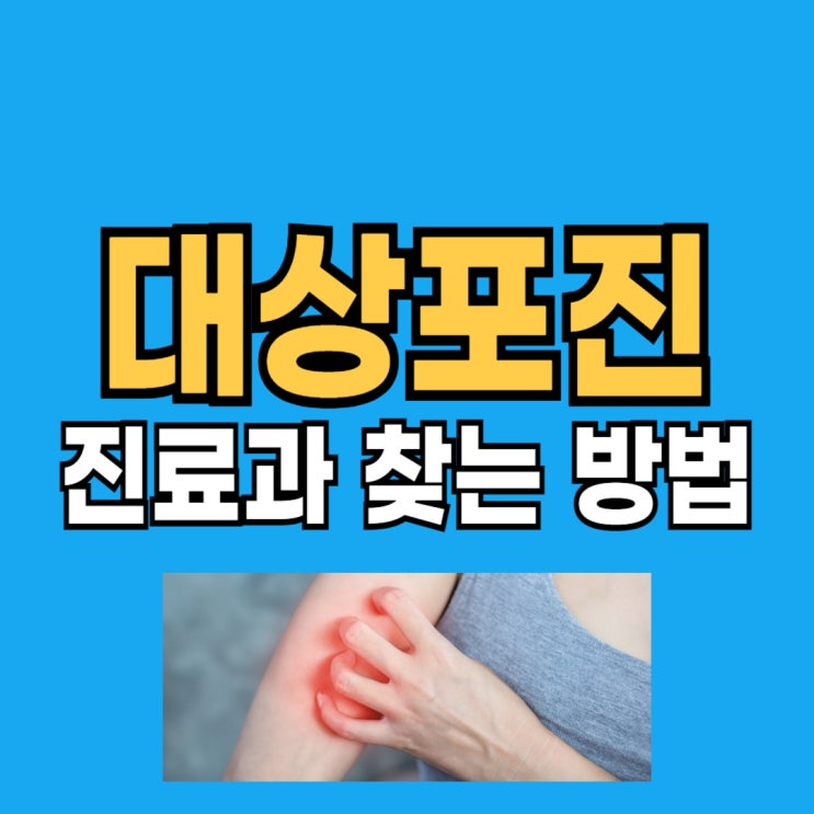  대상포진 진료 병원 무슨과 가야 할까