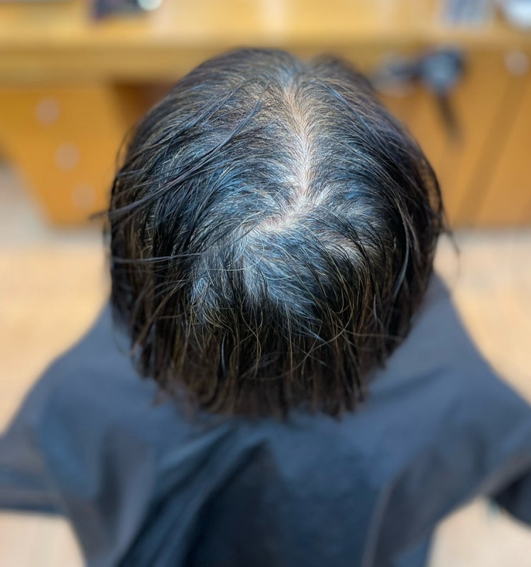  부산여성탈모와탈모커버펌모류교정해독염색복구클리닉두피케어원스톱원탑 럭키비키사상미용실르네시떼헤어샵/ 개금주례명지김해거제창원마산대연동래명륜사직금사반송구덕남포초량영도망미수영