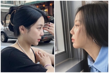 쥬얼리 예원, 코 성형 이유 고백 “귀염상 탈피하고 싶었어요”
