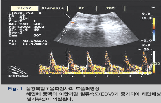  발기부전 검사도 없이 왜 약 처방하지