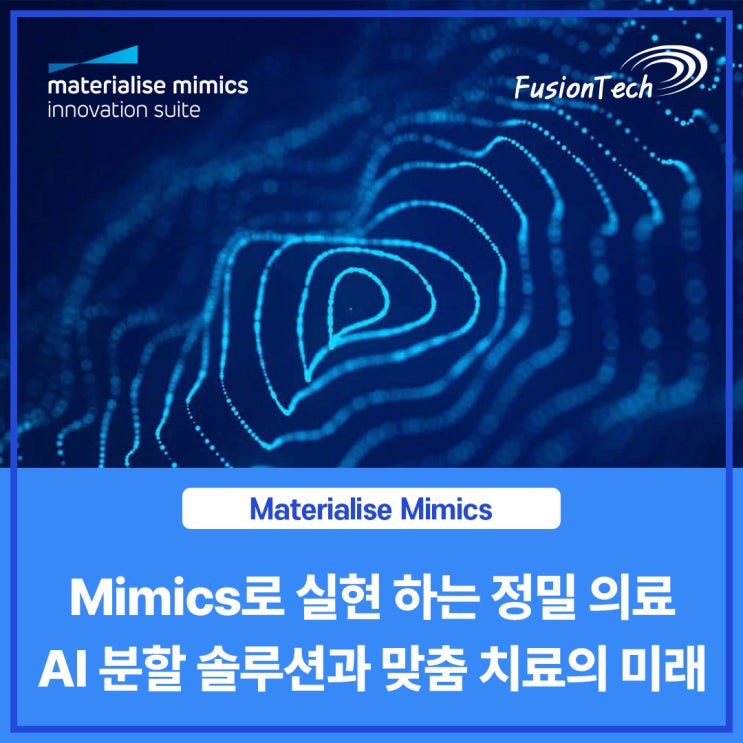  [Materialise S/W] Mimics가 제시하는 AI 분할 솔루션과 맞춤 치료의 미래