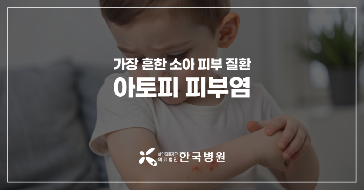  제주 소아청소년과_아기 아토피피부염, 체계적인 치료 관리 중요
