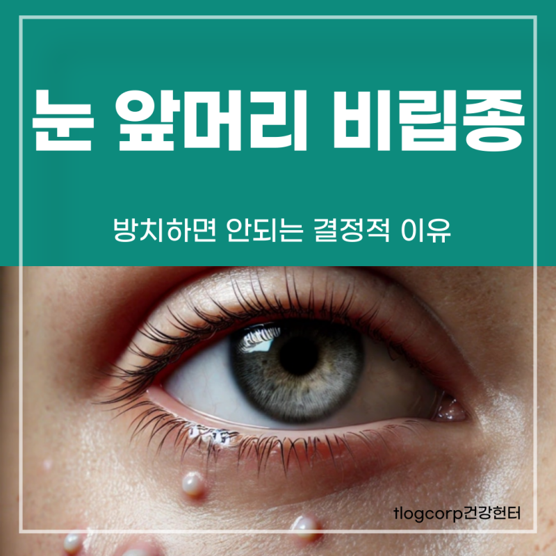눈 앞머리 비립종 방치하면 안되는 결정적 이유