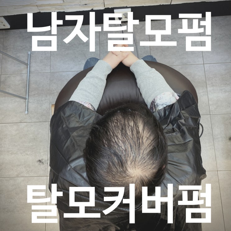  정수리 탈모교정 고민? 수아쌤이 알려주는 40대 링거펌 후기