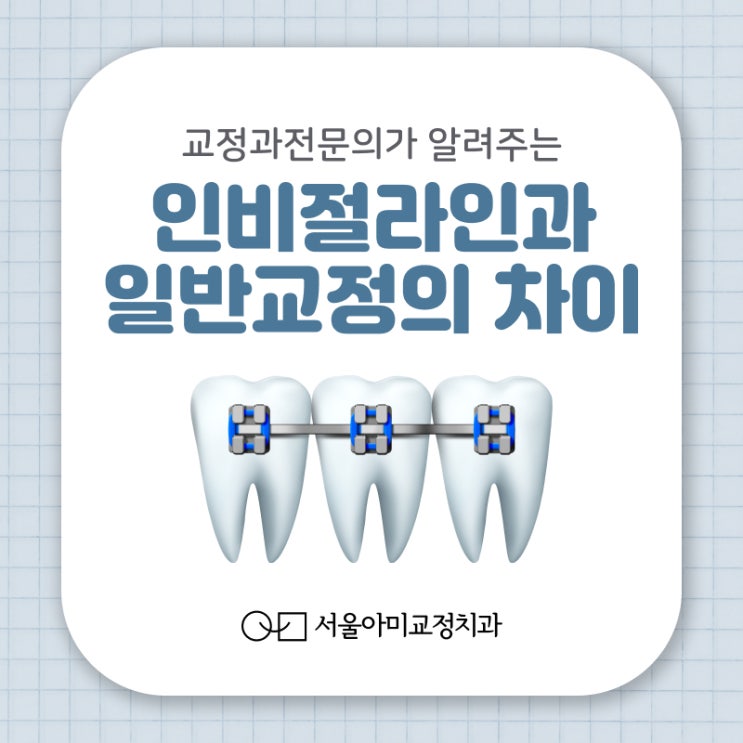  송도신도시치과 교정 장치 선택이 고민이라면