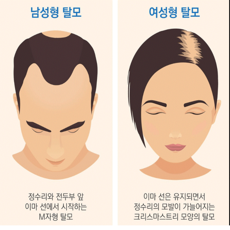  홍합 껍데기는 위대했다…대한민국 탈모인들 '환호'