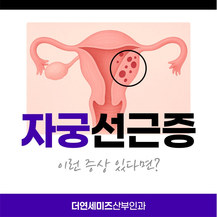  선릉역산부인과 자궁선근증 이런 증상 있다면