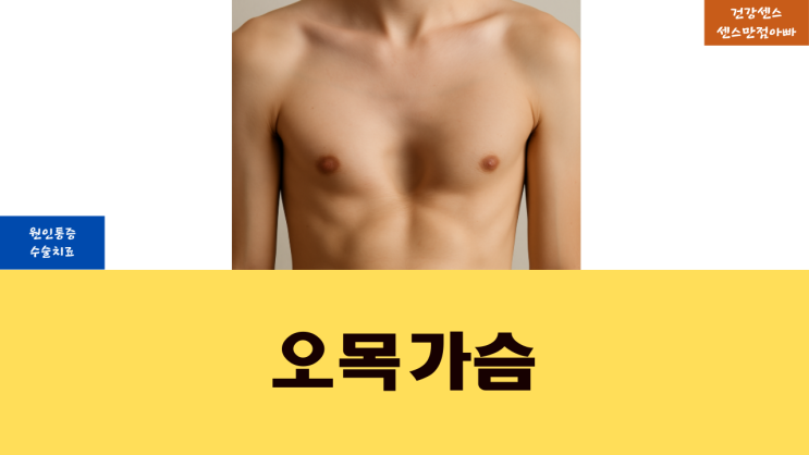  오목가슴 원인 통증 및 수술 치료
