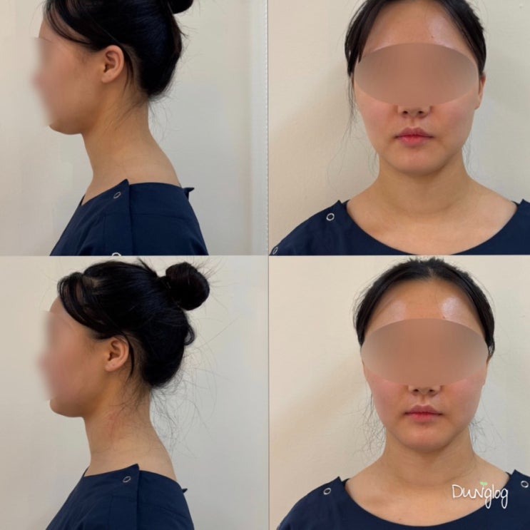  위례 필라테스 체형교정 안면비대칭교정 고민이라면 포핸즈운동센터