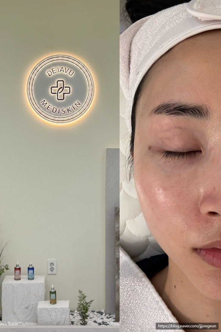  부평역피부샵 여행으로 지친 피부에 수분 충전 완료!!
