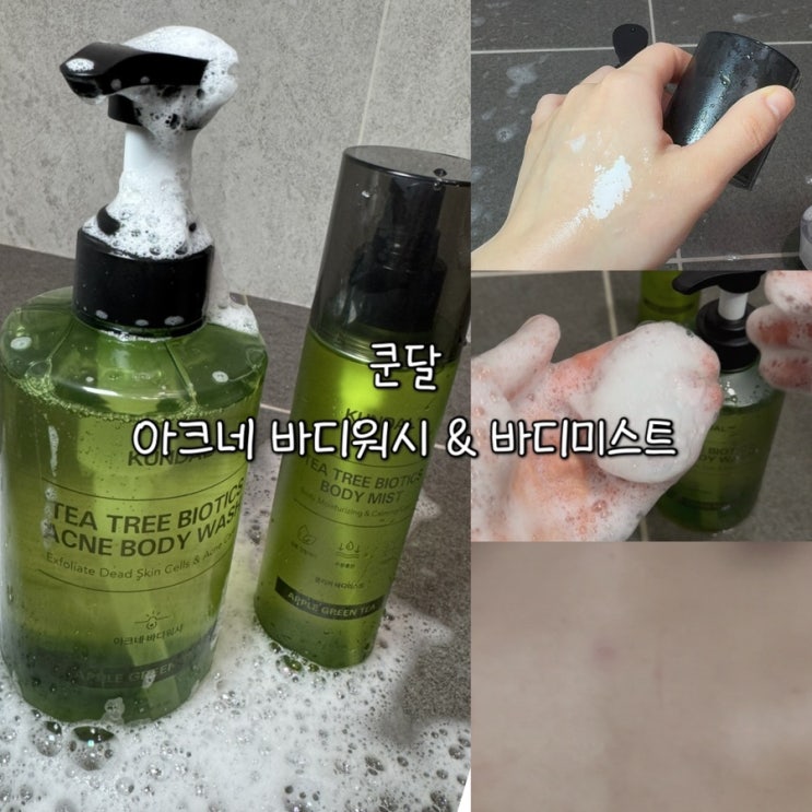  등드름케어 성공ㅣ여드름성피부엔 쿤달 아크네바디워시 바디미스트 추천