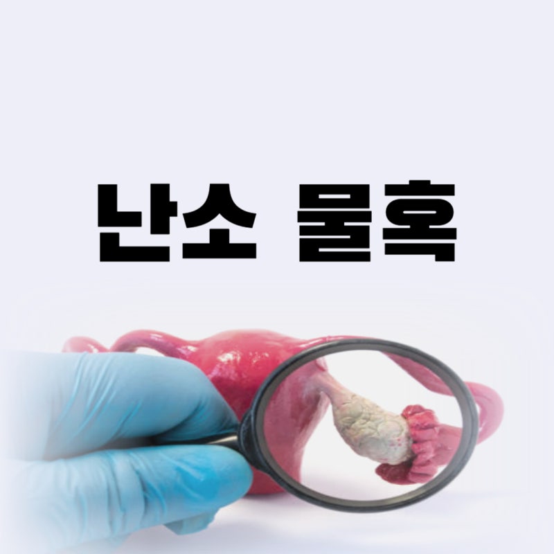 난소 물혹 6cm 4cm 증상 복강경 수술 가능할까 크기별 수술 여부와 회복 총정리