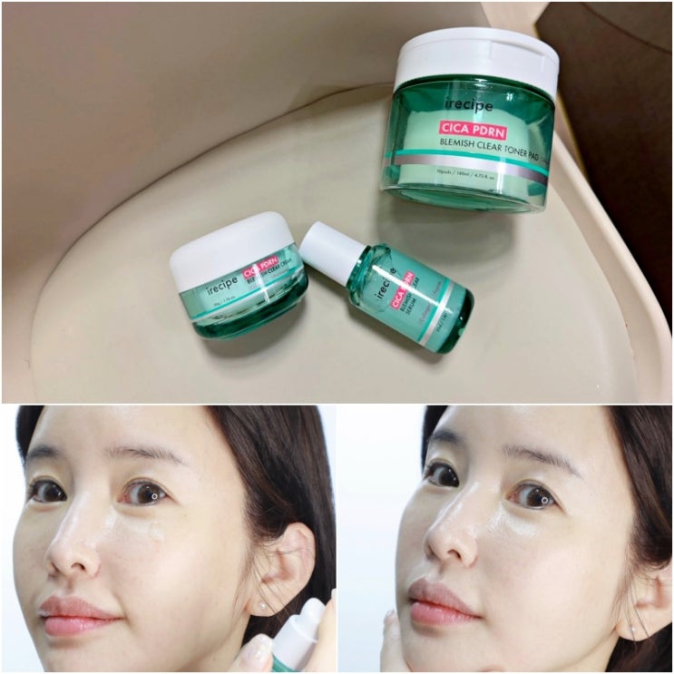 아이레시피 시카PDRN 여행 후 피부진정 안성맞춤! 아이레시피 시카PDRN 여행 후 피부진정 안성맞춤!