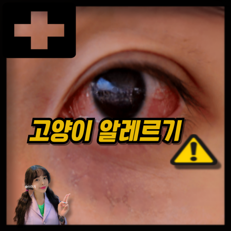  고양이 알레르기 증상 눈꺼풀 부음 고양이털 알레르기 증상