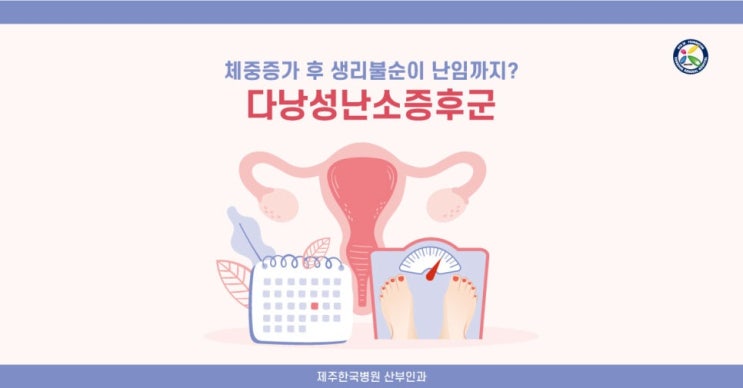  몸무게 늘고 생리불순? 난임 위험 높이는 다낭성난소증후군 주의