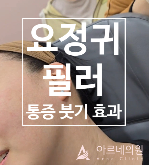  강남서초반포 요정귀 귓바퀴 귓볼필러 효과 시연 아르네의원