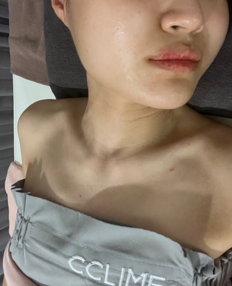  신사 에스테틱 작은얼굴 관리 끌리메 후기