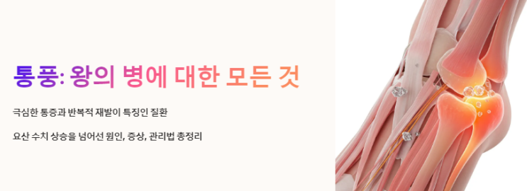  통풍이란? 원인과 증상 총정리 – 미리 알아야 관리가 쉬워요!