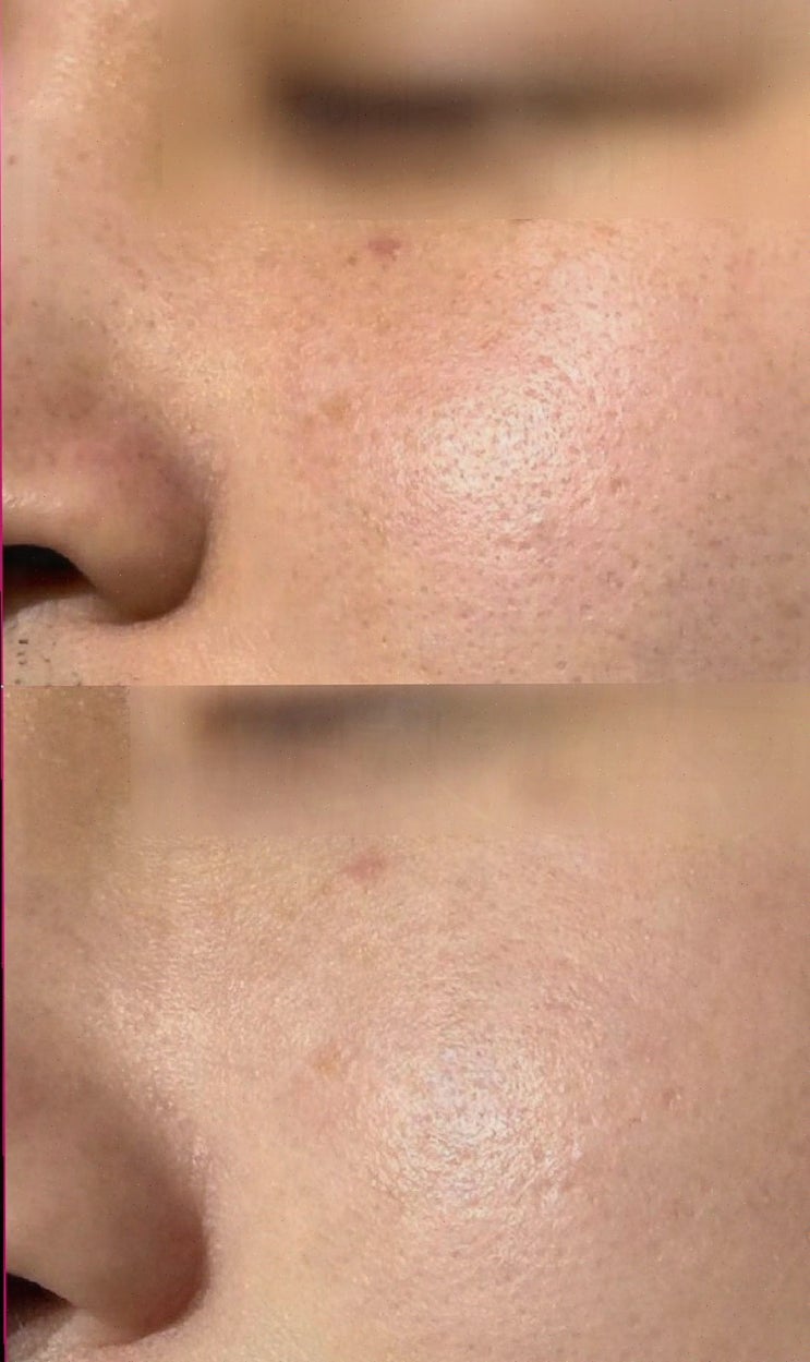  친구와 함께하는 특별한 피부 관리 경험, 퇴계동피부관리