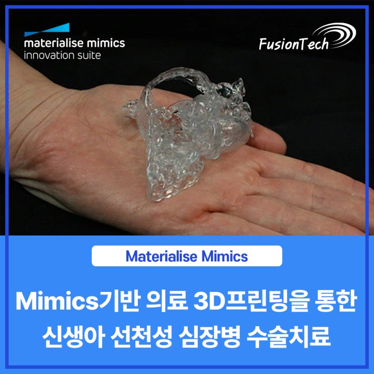  [Materialise S/W] Mimics 기반 의료 3D프린팅을 통한 신생아 선천성 심장병 수술치료