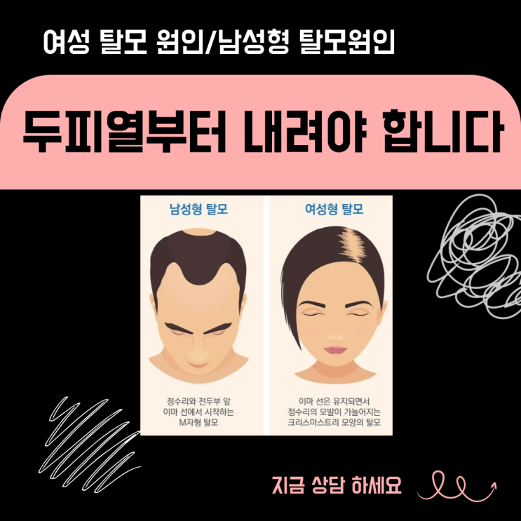  “원장님, 이거 진짜 탈모샴푸예요?” 고객님들이 가장 많이 물어보는 질문 3가지