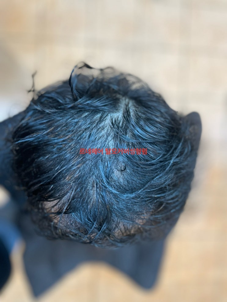  남자탈모펌하고 봄나들이 딱좋아 부산남여탈모고민 여기야여기 / 김해거제창원마산울산양산용원화명대저녹산장유연제사직동래온천명륜금정북항신평대연감만양정개금주례