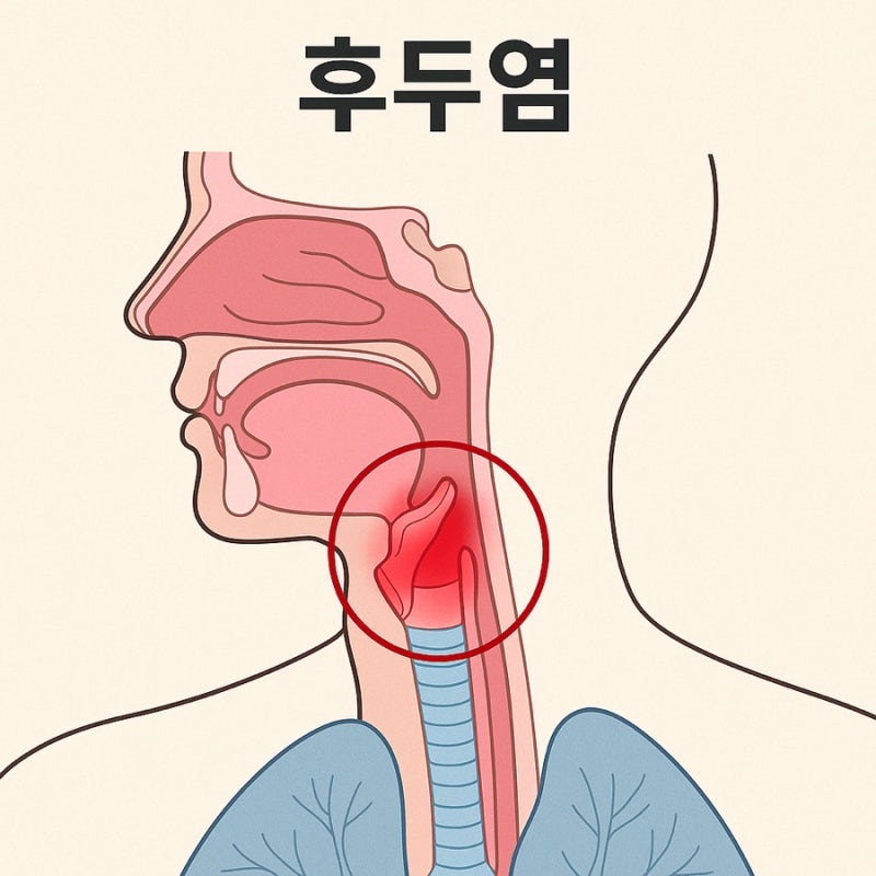 후두염에 좋은 음식 역류성 후두염 음식 약 보다 중요합니다.