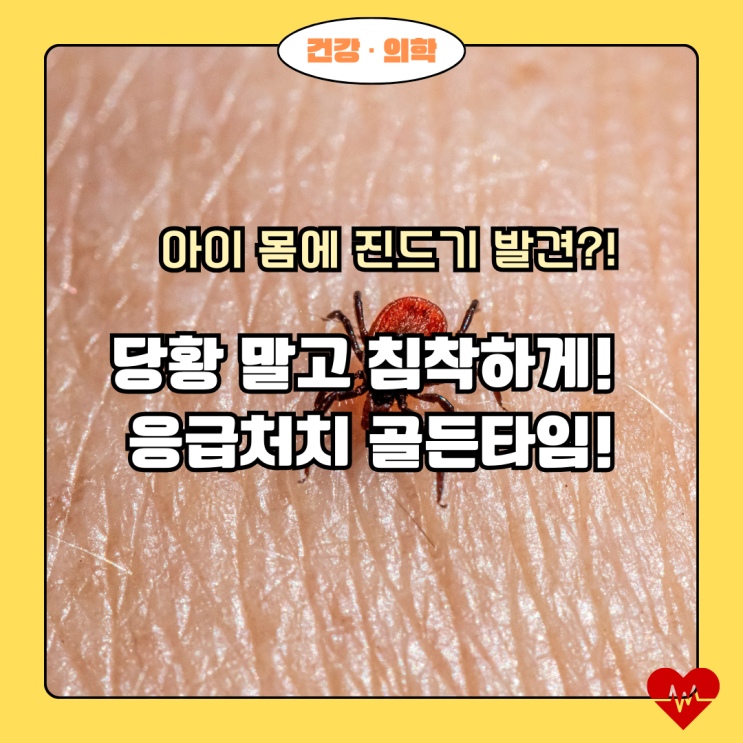  침착함이 생명! 아이 진드기 발견 시 엄마 아빠 행동 요령