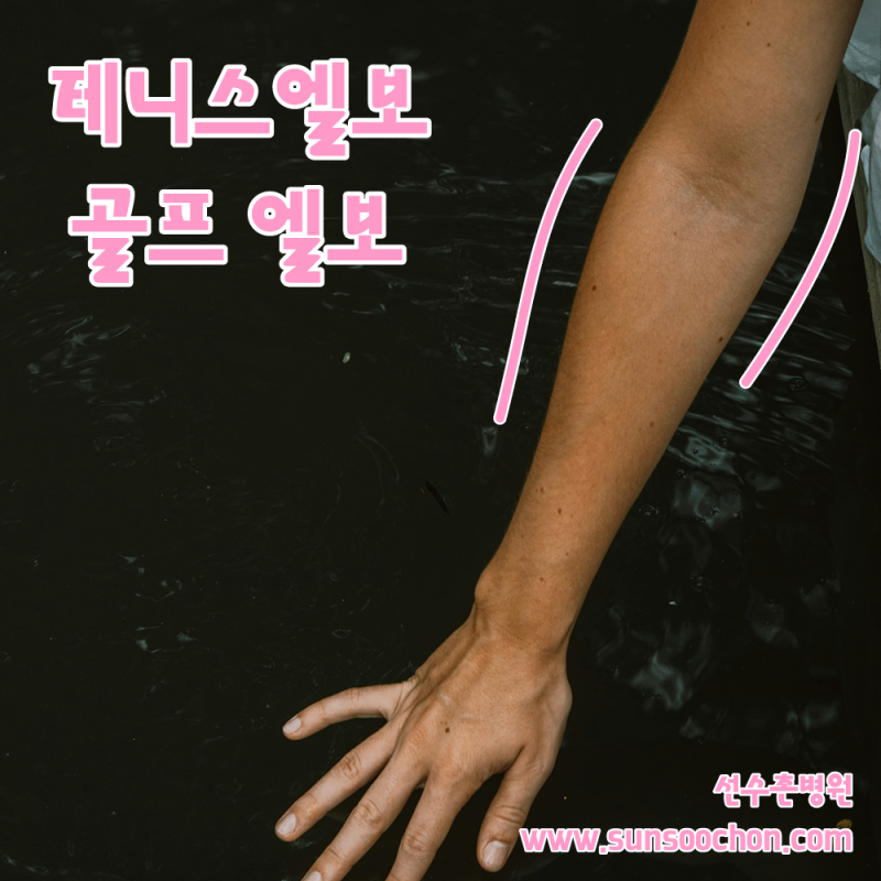 테니스 엘보 골프 엘보, 통증을 유발하는