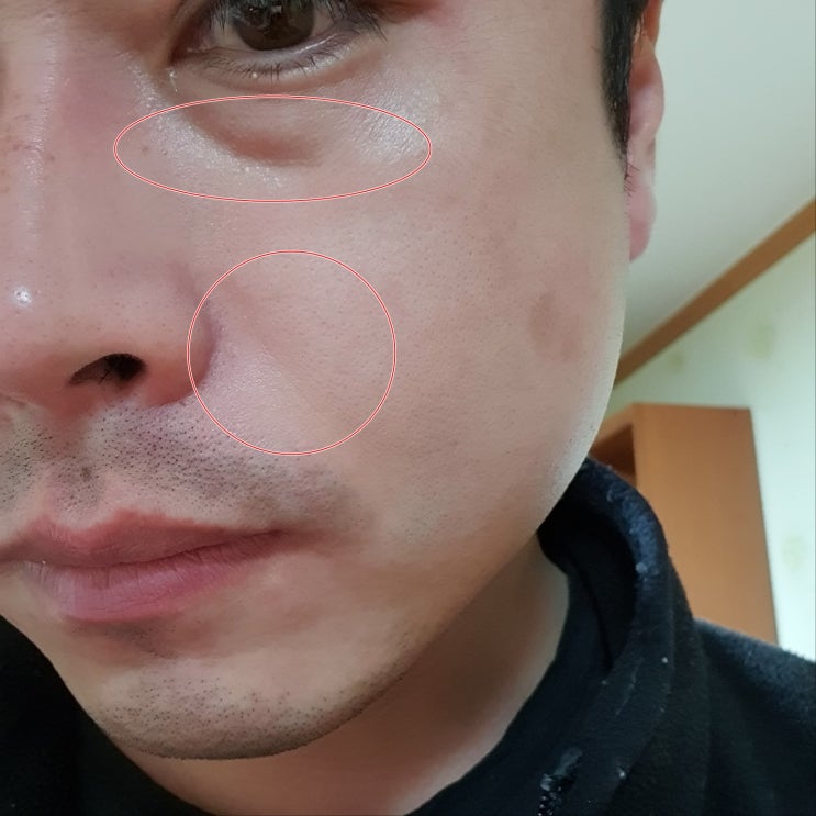  레티놀 크림 효과 및 올바른 사용방법 추천제품