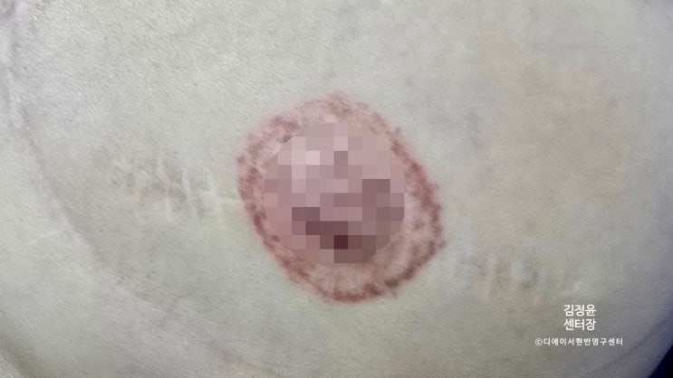  유륜 재건 타투 교육, 반영구 의료 타투 전문 교육센터