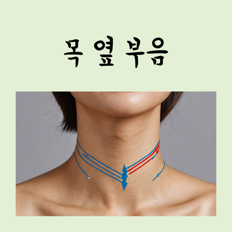 목 옆 부음 생겼는데 왜 그럴까? 림프절염부터 감염까지 원인 정리