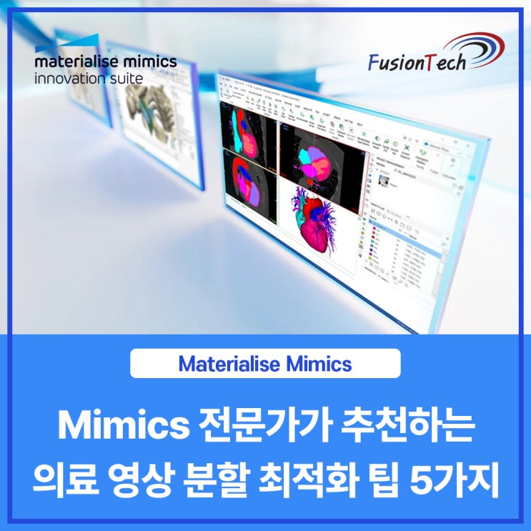  [Materialise S/W] Mimics 전문가가 추천하는 의료 영상 분할 최적화 팁 5가지