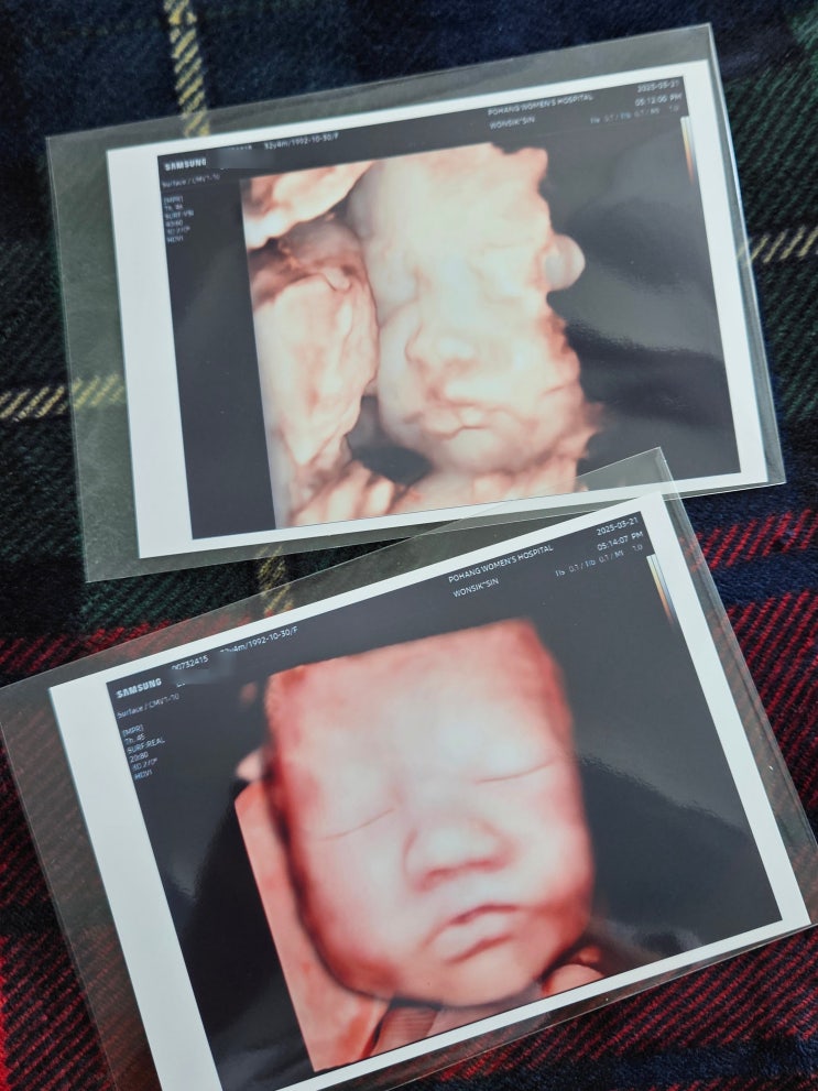  임신 29주 5일 포항여성병원 입체 초음파 AI 후기