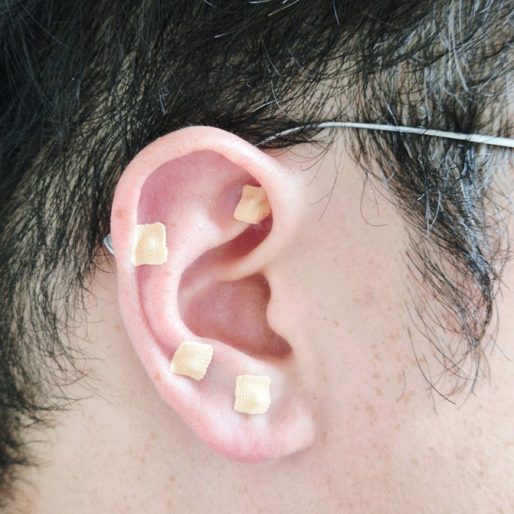  귀지압패치 사용후기-귀랑 손에 붙여 수지침처럼 (귀혈자리, 손바닥 혈자리 위치)