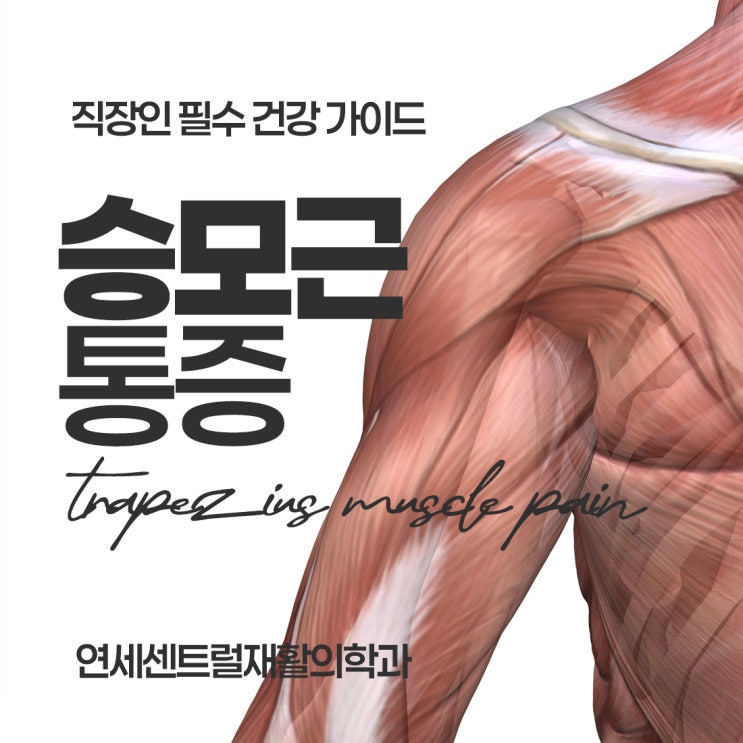  을지로3가정형외과, 어깨 뻐근한 직장인 승모근 통증예방
