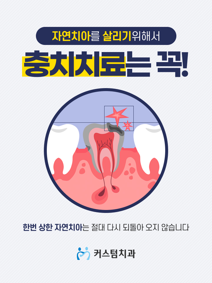  부천충치치료 후회 없는 선택을 위해 알아두면 좋은 점