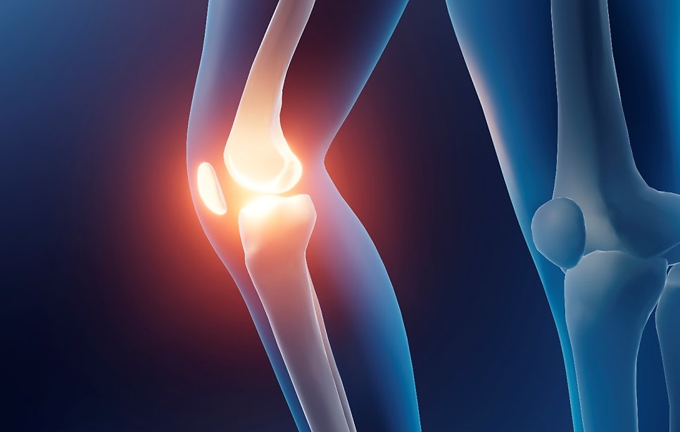 What are the causes and treatments for knee pain, and how should it be managed after surgery? — 본문 그림