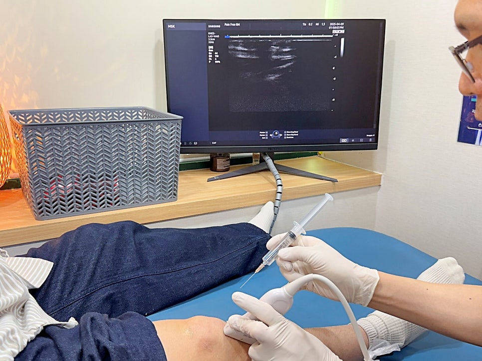 What are the causes and treatments for knee pain, and how should it be managed after surgery? — 본문 그림