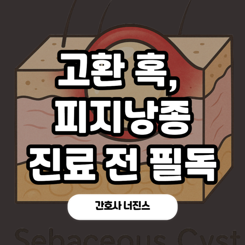 고환혹 고환 피지낭종, 언제 병원 가야할까? 간호사가 알려드려요.