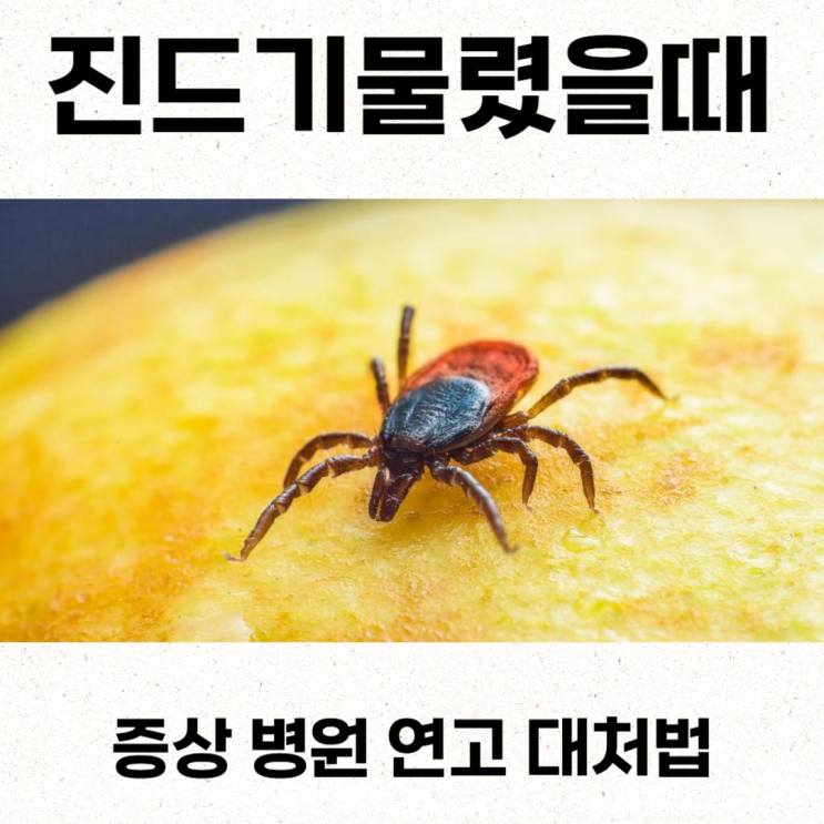  진드기물렸을때 증상 병원 연고 대처법