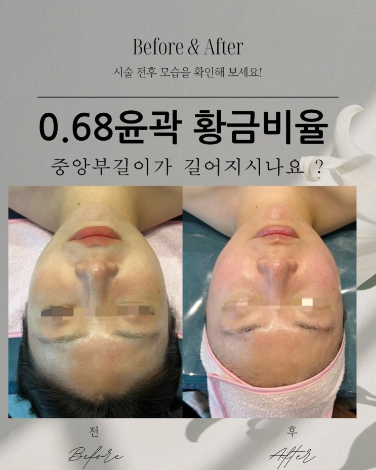  동래피부관리 왜 거울속 내 얼굴이 점점 길어질까?